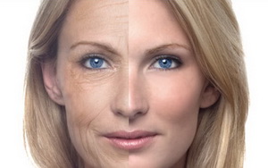 Преимущества фотоомоложения